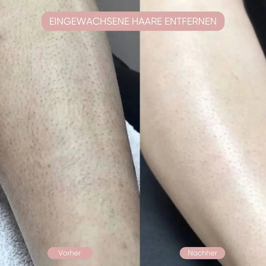 Pelvora Glide™ 2-in-1 Intimrasierer