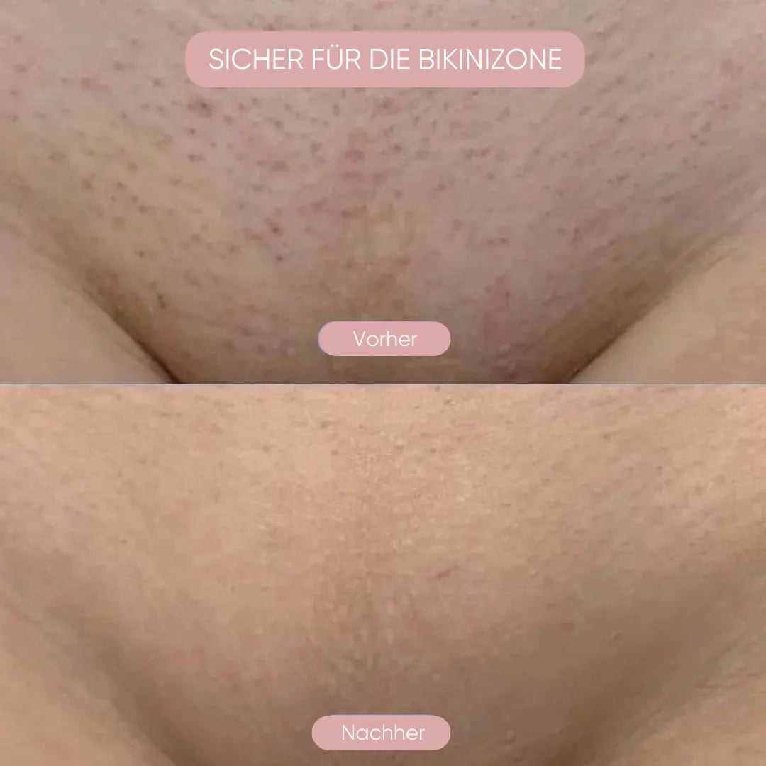 Pelvora Glide™ 2-in-1 Intimrasierer