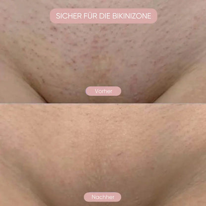 Pelvora Glide™ 2-in-1 Intimrasierer