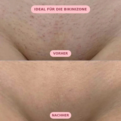 Pelvora Silk - Schmerzfreies Enthaarungsspray für die Intimzone