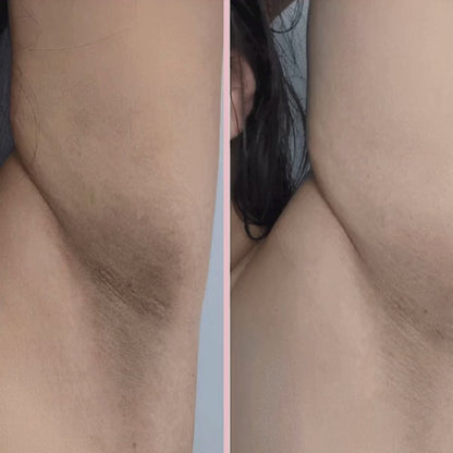 Pelvora Glide™ 2-in-1 Intimrasierer